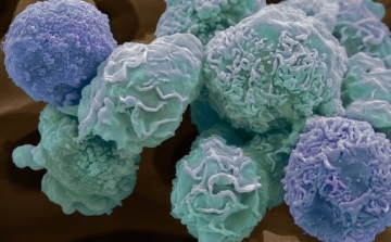 A rákhoz vezető génmutációk okait tárta fel egy kutatás