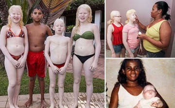 Hatból három gyereke albinizmussal született egy színes bőrű brazil nőnek ( fotók )